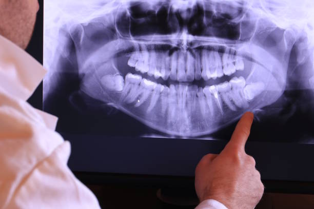 Best Orthodontic Emergency Dentist in South Glens Falls, NY