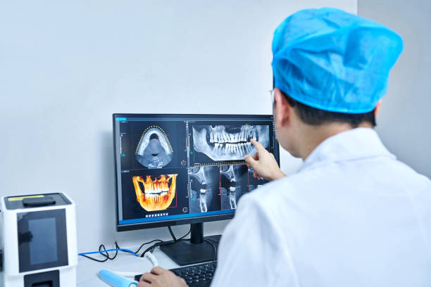 Best Emergency Dentist for Knocked-Out Tooth in South Glens Falls, NY