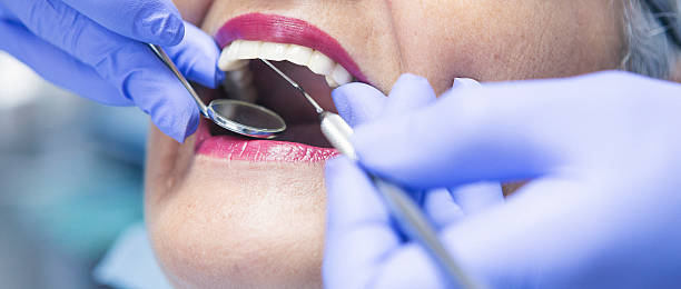 Best Emergency Dental Services for Seniors in South Glens Falls, NY